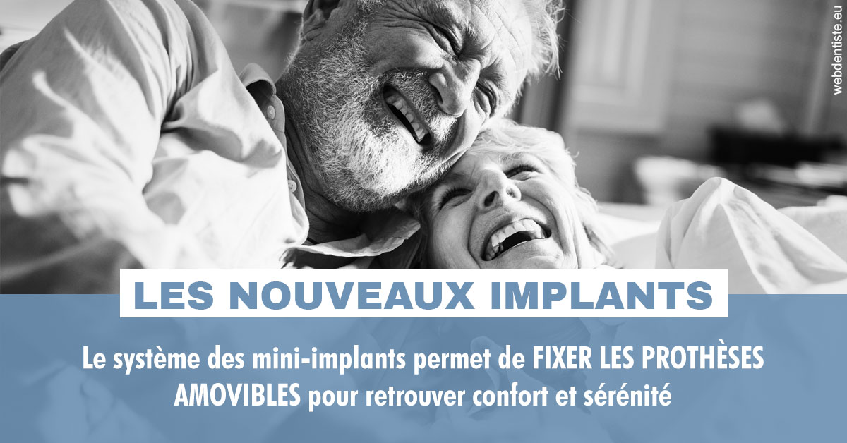 https://lavilla-aix.fr/Les nouveaux implants 2