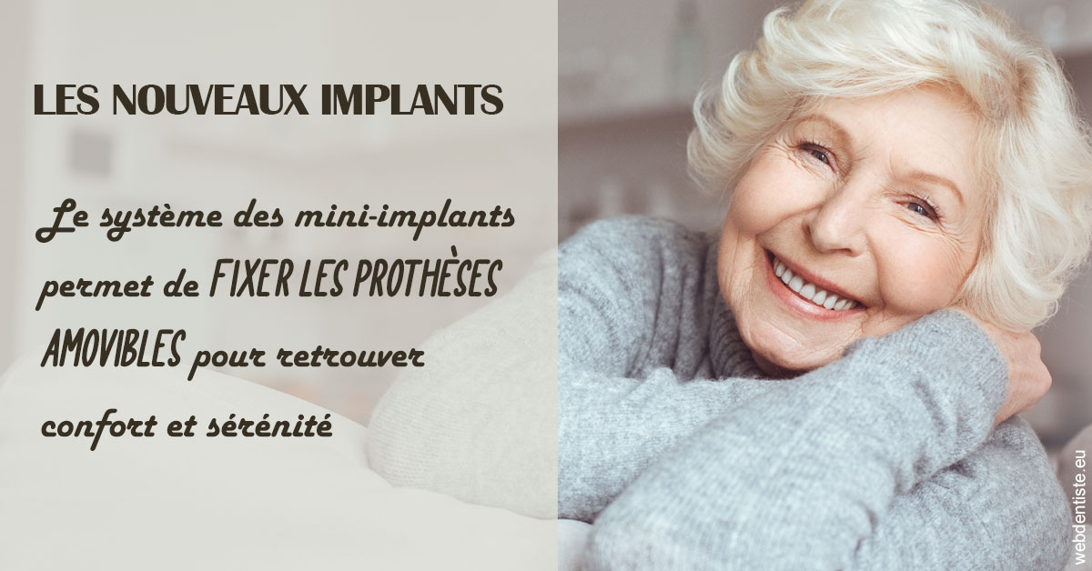 https://lavilla-aix.fr/Les nouveaux implants 1