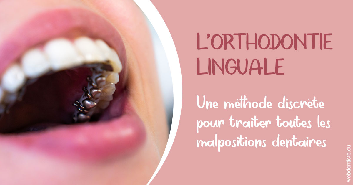 https://lavilla-aix.fr/L'orthodontie linguale 2