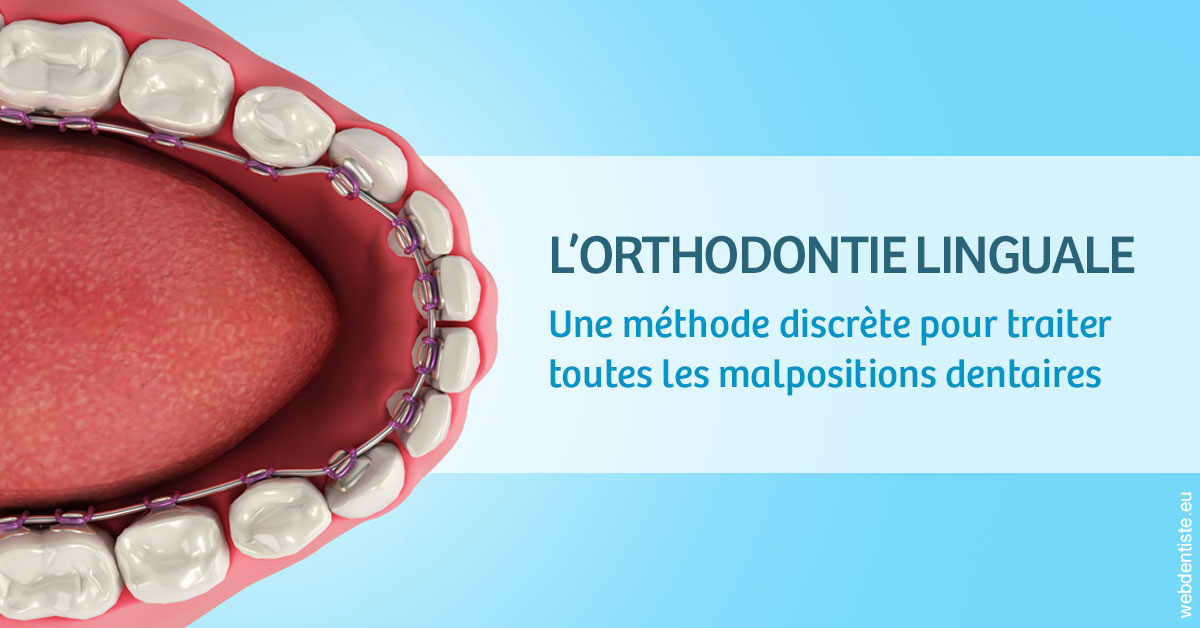 https://lavilla-aix.fr/L'orthodontie linguale 1