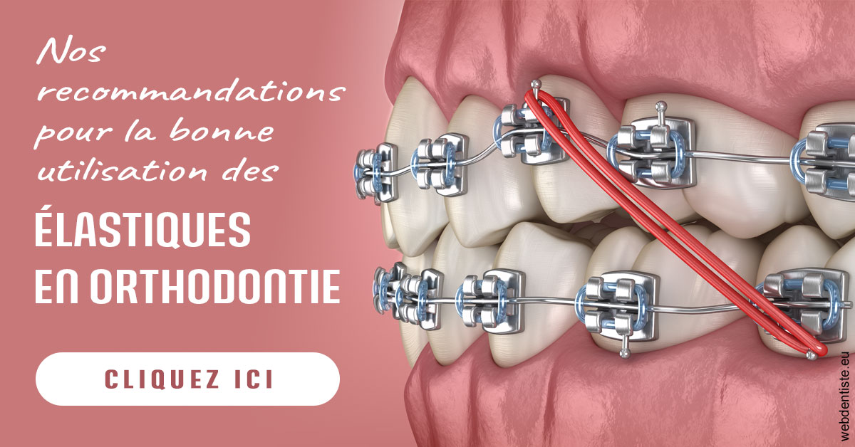 https://lavilla-aix.fr/Elastiques orthodontie 2